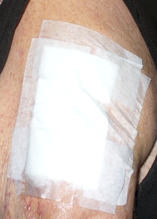 Bandaging by Chuck